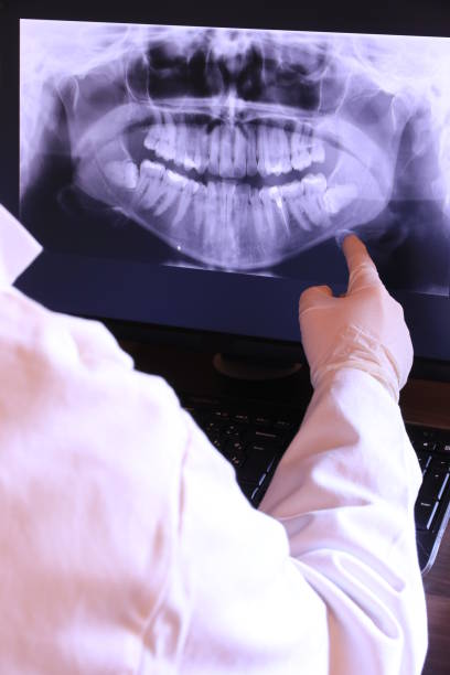 Best Root Canal Emergency Dentist  in East Bangor, PA